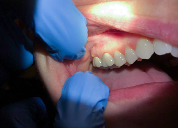 Best Cosmetic Emergency Dentistry in Arp, TX